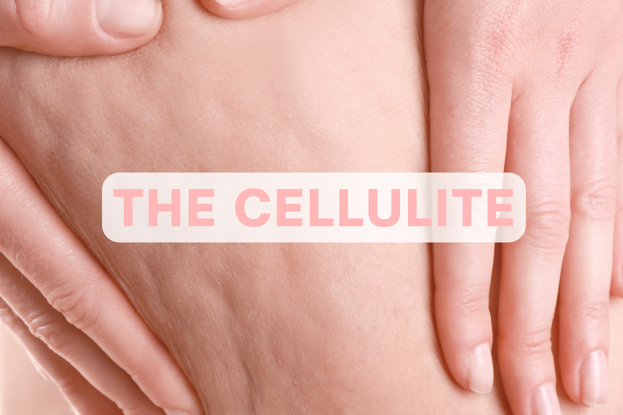 What is cellulite ?